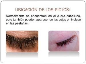 Piojos en pestañas y cejas